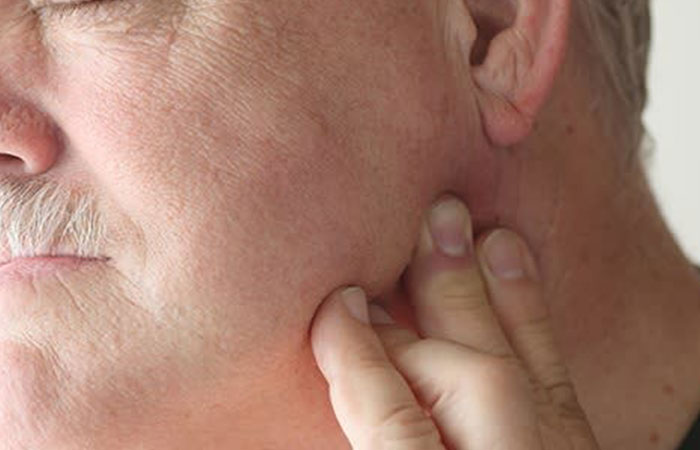 trouble_de_larticulation_temporo-mandibulaire